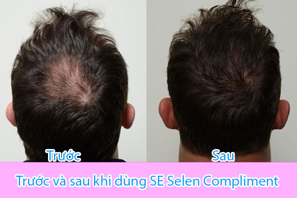 Bộ sản phẩm giúp bình thường hóa vòng đời của nang tóc, làm tăng độ dày và chiều dài của tóc trong giai đoạn tăng trưởng