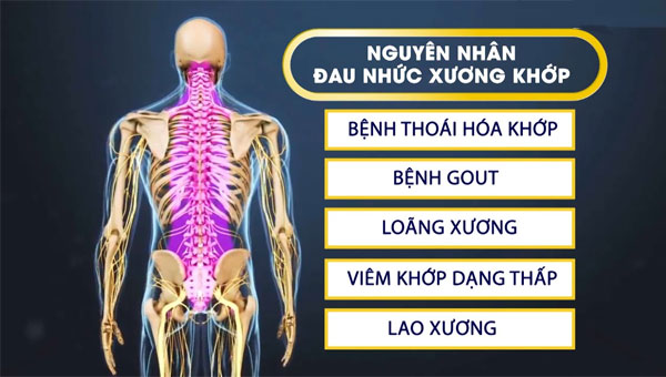 Có khá nhiều nguyên nhân để dẫn đến tình trạng đau nhức xương khớp