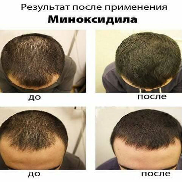Khả năng nuôi dưỡng từ sâu bên trong giúp tóc chắc khỏe và đàn hồi hơn