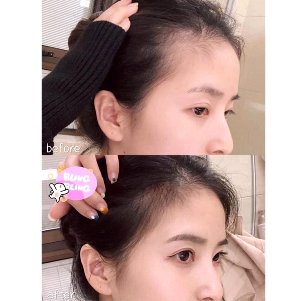 Kết quả trước và sau khi sử dụng dầu gội Kaminomoto