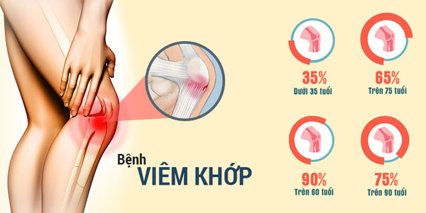 Bệnh xương khớp như thoái hóa, thoát vị,… không chỉ xuất hiện ở người già mà trong những năm gần đây đang có xu hướng gia tăng nhanh ở người trẻ