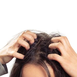 Thuốc trị nấm da đầu